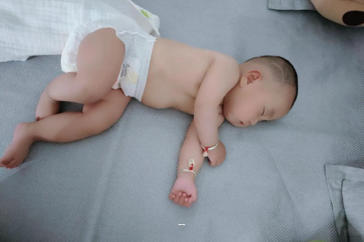 莱州宝宝脸上有白色斑块